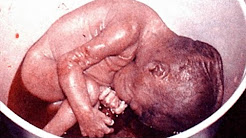 ABORTED BABY 666