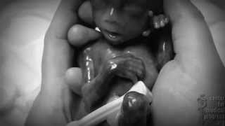 ABORTION ABOMINATION (2)